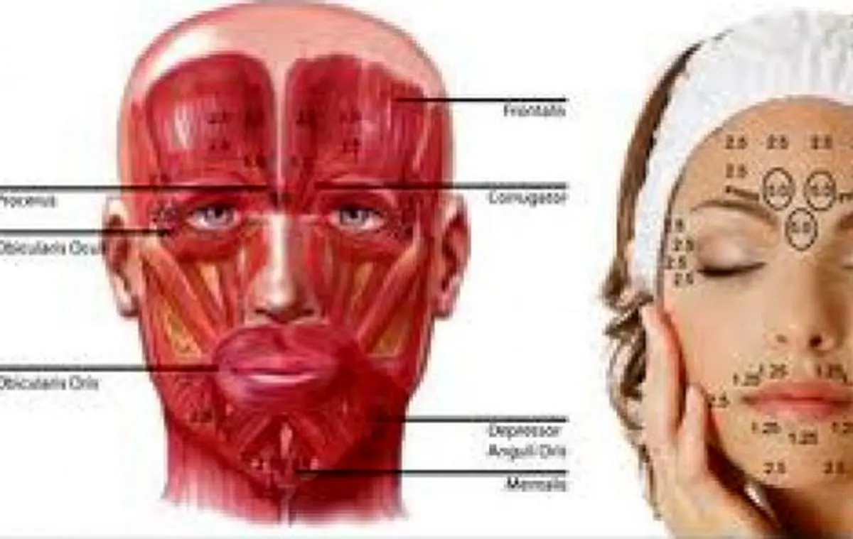 بوتاکس تزریق می‌کنم، پس هستم!
