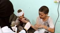 43 هزار نفر در یمن کشته و زخمی شده‌اند
