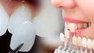 مناسب‌ترین شیوه تغییر فرم دندان‌ها به جای ارتودنسی